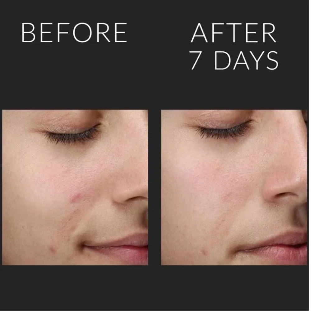 Kate‎ Somerville Liquid ExfoliKate Triple Acid Resurfacing Treatment